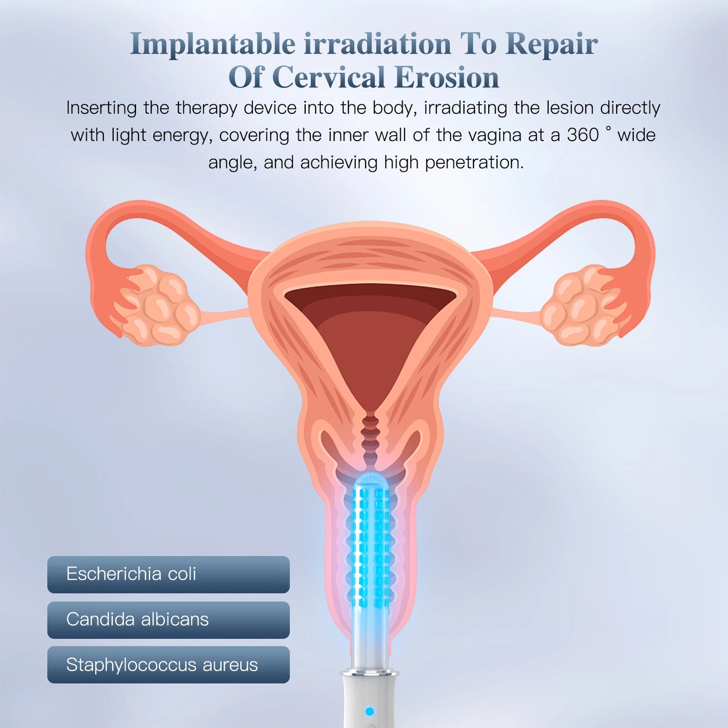 KTS Wireless Vaginal Vibrator Massager with Red Light Therapy for Vaginitis & Vaginal Tightening