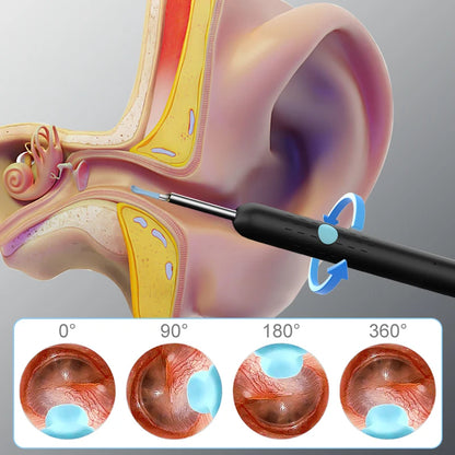 WiFi Visual Ear Sticks – HD 1080P 4.2MM Mini Otoscope Camera, Wireless Ear Picker & Cleaner, Endoscope for Ear Wax Removal & Health Care