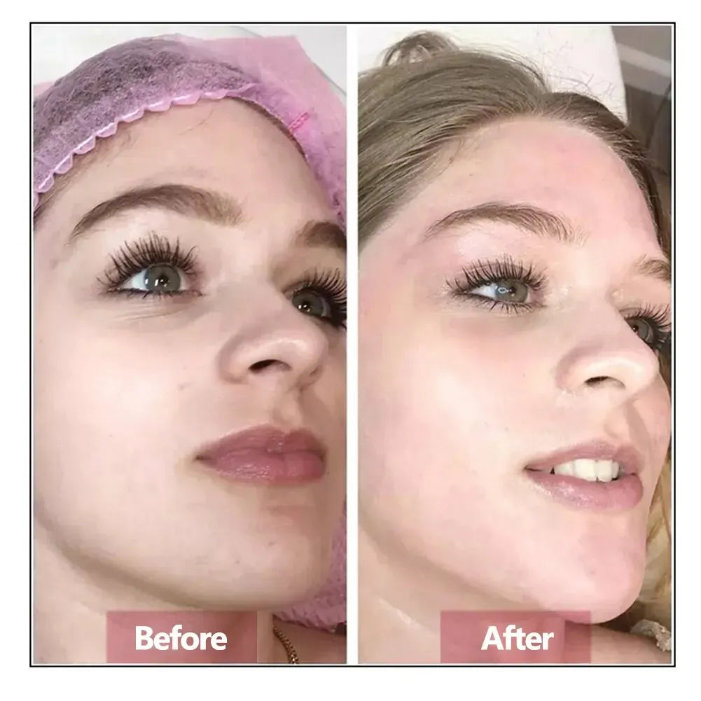 Hyaluronic Acid Face Serum – Hydrating, Moisturizing & Anti-Aging Skin Repair Essence