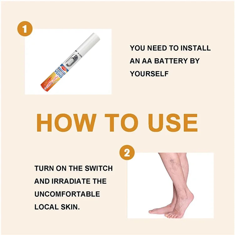 Medical-Grade Laser Treatment for Varicose & Spider Veins – Painless Leg Vein Therapy Equipment