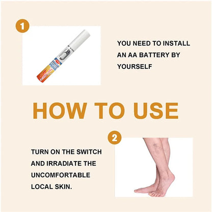 Medical-Grade Laser Treatment for Varicose & Spider Veins – Painless Leg Vein Therapy Equipment