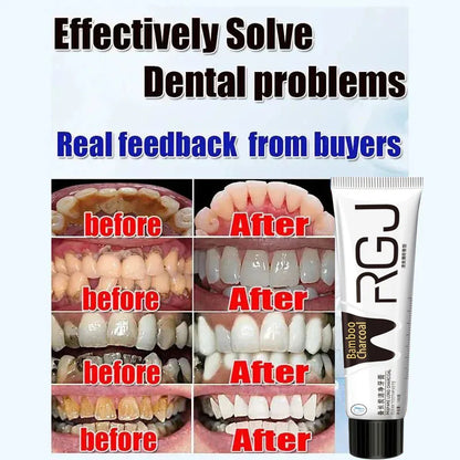 Dental Calculus Remover & Whitening Toothpaste – Fresh Breath & Periodontitis Prevention