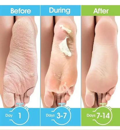 Honey Foot Mask – 1 Pair for Dead Skin & Callus Removal, Exfoliating Foot Treatment, Whitening Foot Spa & Skin Care Tool