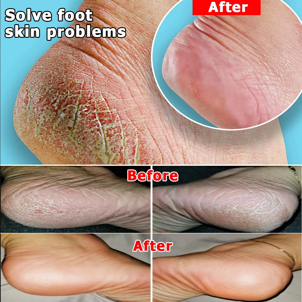 FlowWeek Exfoliating Foot Mask – Removes Dead Skin, Calluses & Dry, Chapped Feet for Smooth, Soft Skin