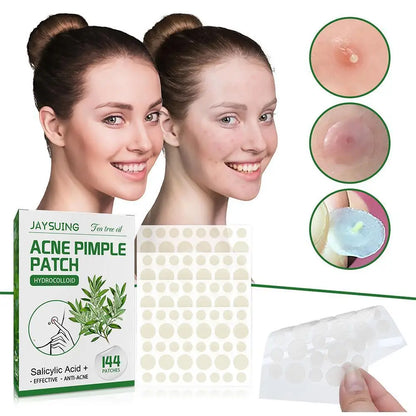 144 Pack Acne Pimple Patches – Translucent Matte Hydrocolloid with Salicylic Acid & Tea Tree Oil for Whiteheads & Inflamed Acne