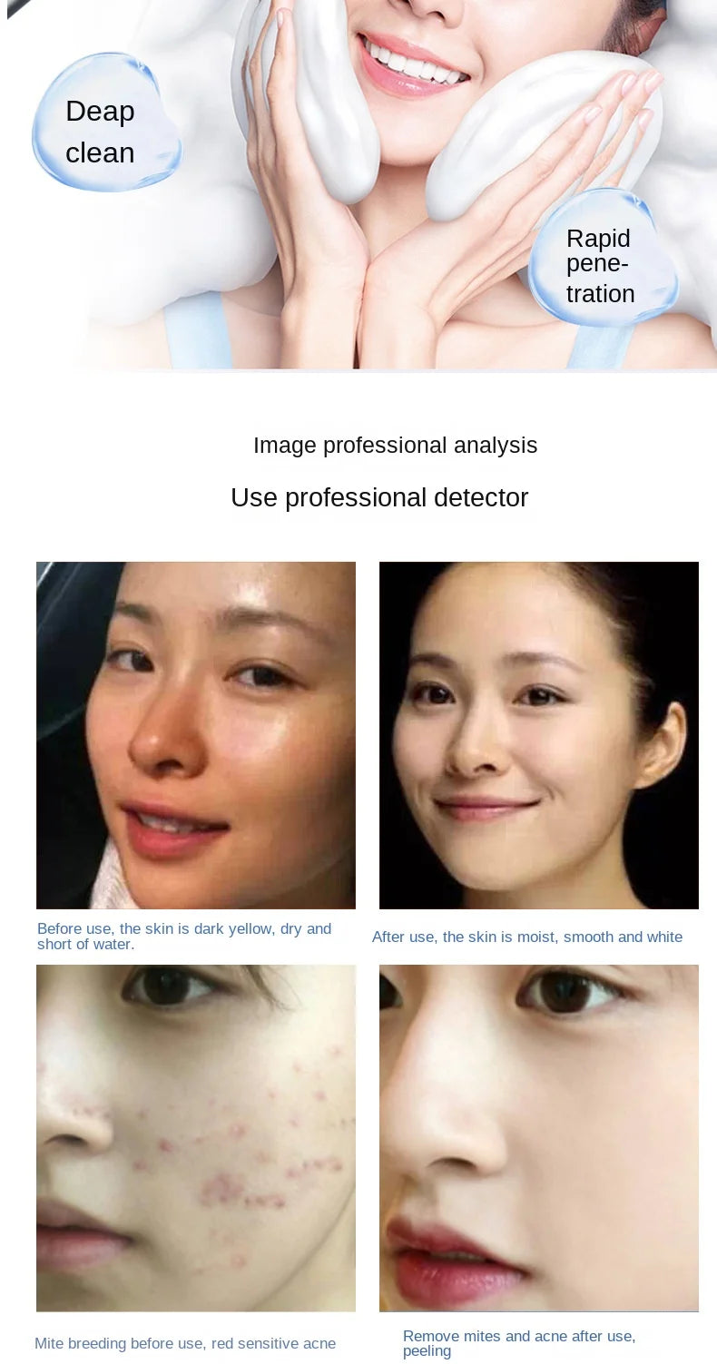 Magic Oxygen Bubble Machine - Deep Clean for Tender White Skin, Cleansing Mites, Beauty Facial Rejuvenation - Japan Management Device