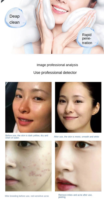 Magic Oxygen Bubble Machine - Deep Clean for Tender White Skin, Cleansing Mites, Beauty Facial Rejuvenation - Japan Management Device