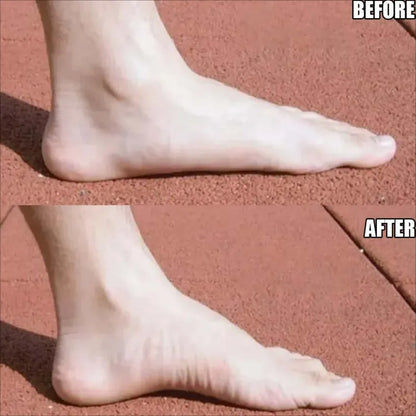 Flat Foot Support Insoles - Breathable PU Corrective Shoe Inserts for Comfortable Everyday Wear