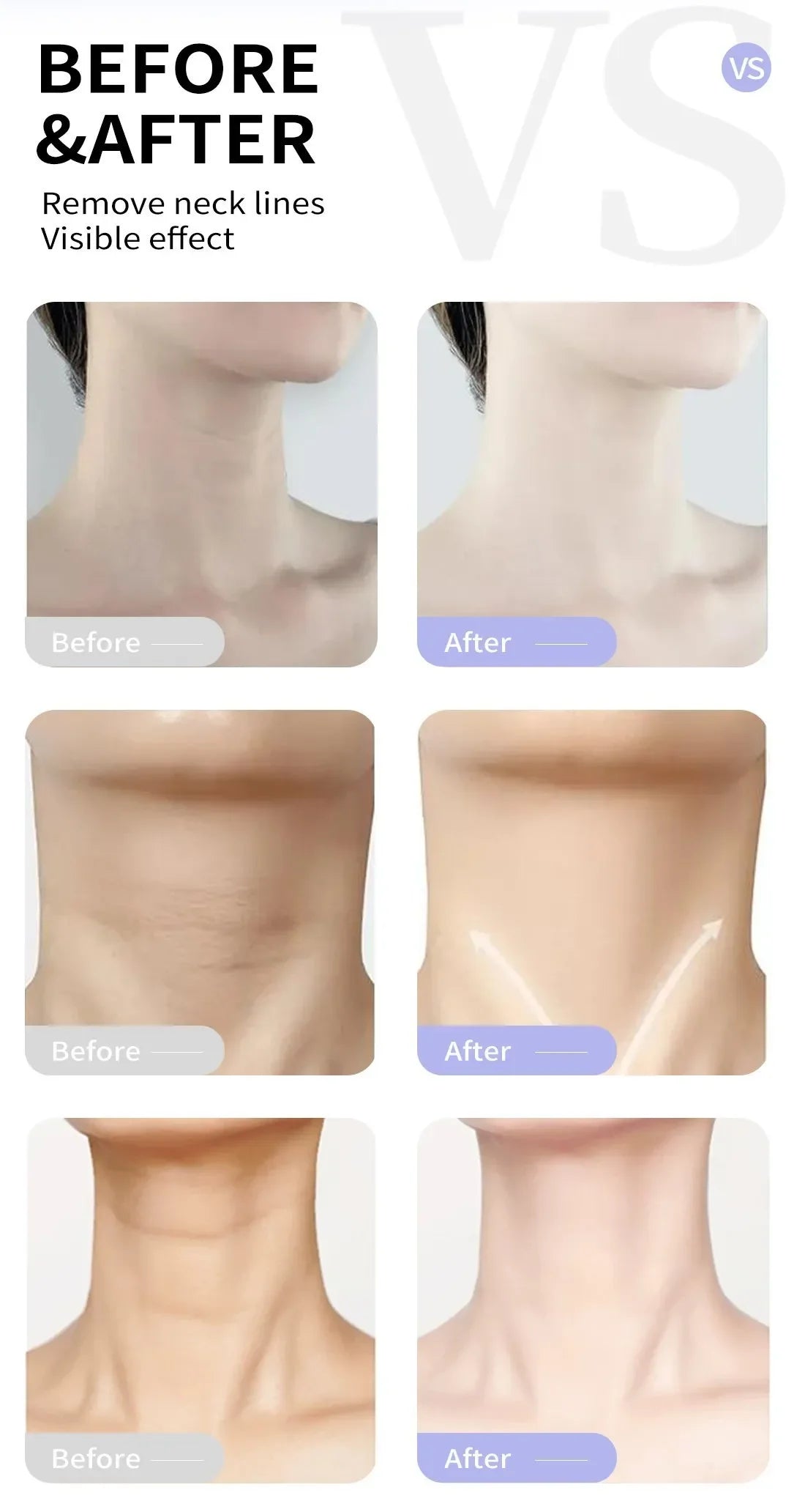 Rtopr Neck Cream — Reinforced Wrinkle Removal, Whitening & Moisturizing, Rejuvenating Neck Skincare