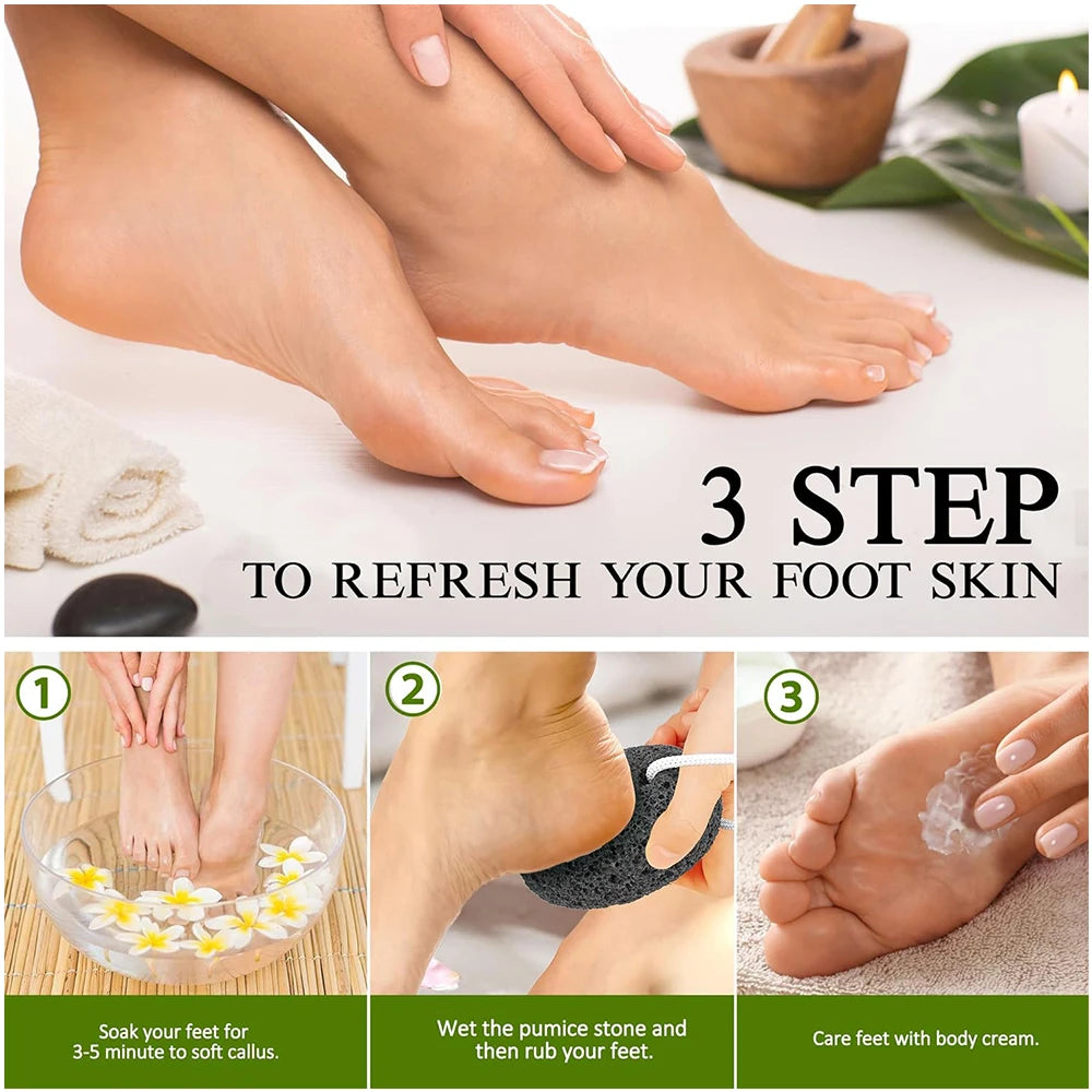 Natural Lava Pumice Stone Callus Remover — Foot, Heel & Palm Exfoliating Scrubber for Hard Skin Care