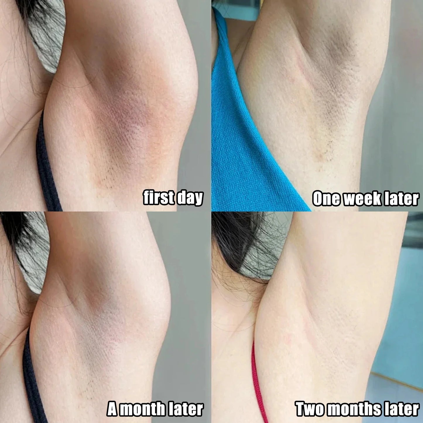 Brightening Body Serum Cream – Underarm, Knee & Inner Thigh Skin Care Moisturizer for Even Tone, Dark Spot Care & Smooth Skin Appearance