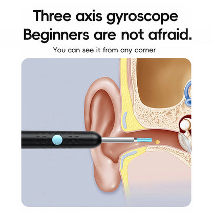 Smart Visual Ear Cleaner Set with 1080P Camera – WiFi Ear Wax Removal Tool with HD LED Lights & Earpick Endoscope