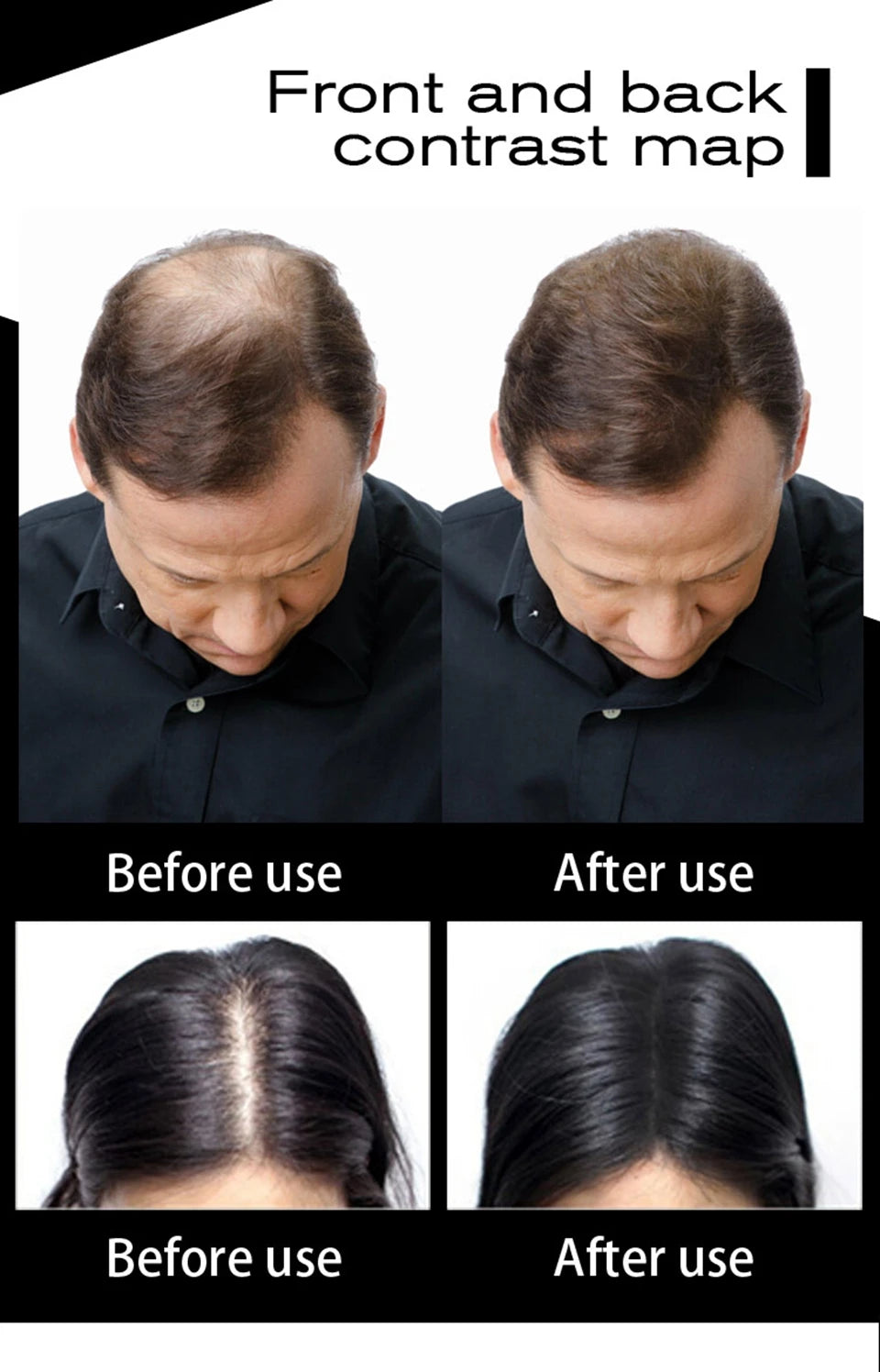 SEVICH Keratin Hair Fiber 100g – Hair Thickening & Building Powder Spray, Instant Regrowth & Hair Loss Concealer