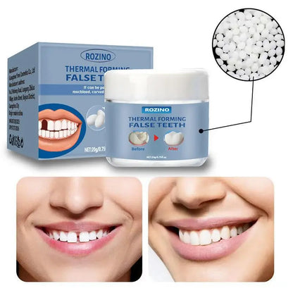 Moldable False Teeth Repair Kit – Tooth Granules & Beads for Temporary Filling, Broken Tooth Fix, Thermal Fit Q6N2