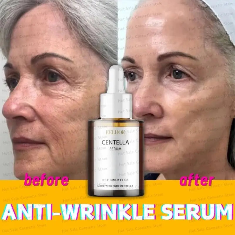 Centella Asiatica Face Serum – Nourishing, Brightening & Moisturizing Cream for Dry Skin Rejuvenation