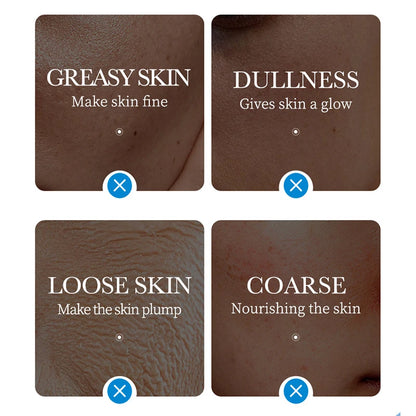 SADOER Ice Face Masks 5pcs – Deep Hydrating, Moisturizing, Brightening & Firming Facial Sheet Masks for Skin Care