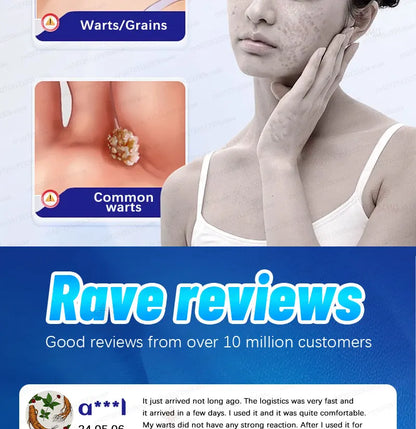 Safe Skin-Friendly Wart Removal Methods – Gentle Solutions for Effective Wart Treatment