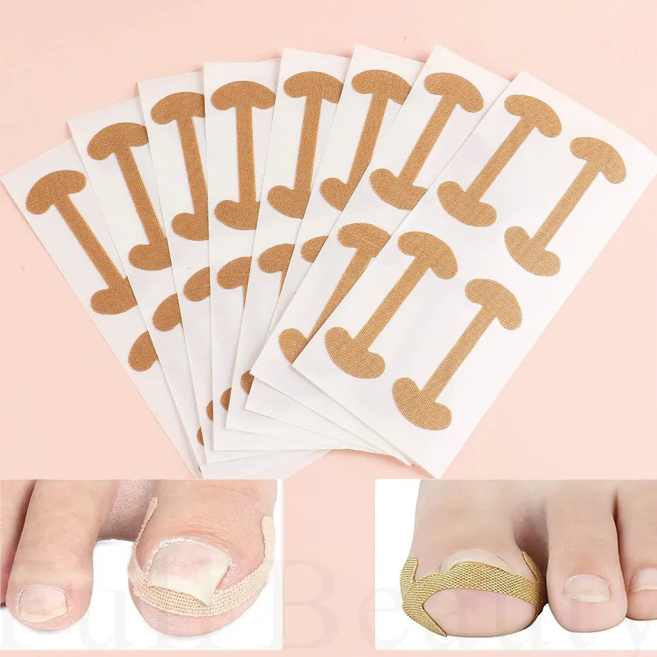 Ingrown Nail Correction Stickers - 40/100/200pcs Toenail Corrector Patches for Paronychia Treatment and Pedicure Recovery
