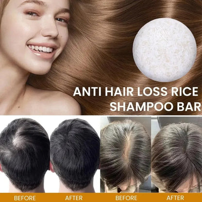 Organic Rice Shampoo Bar – Oil-Free, Nourishing Hair Growth & Anti-Hair Loss