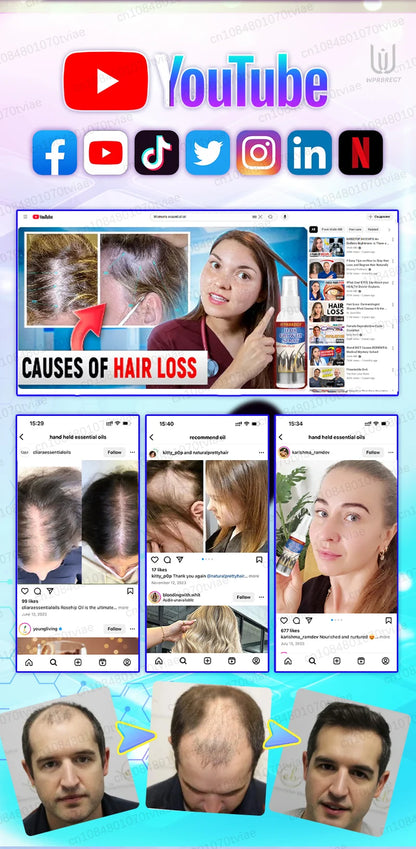 Hair Water Spray – Specially Formulated for Regular Use to Nourish and Revitalize Hair
