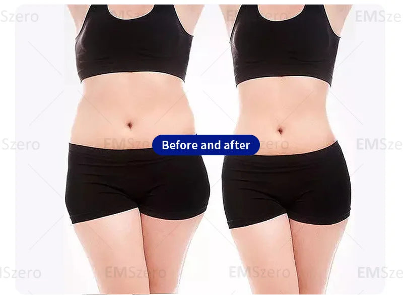 EMSzero Mini Body Sculpting Machine | NEO RF Electromagnetic Muscle Stimulation & Fat Removal 2025