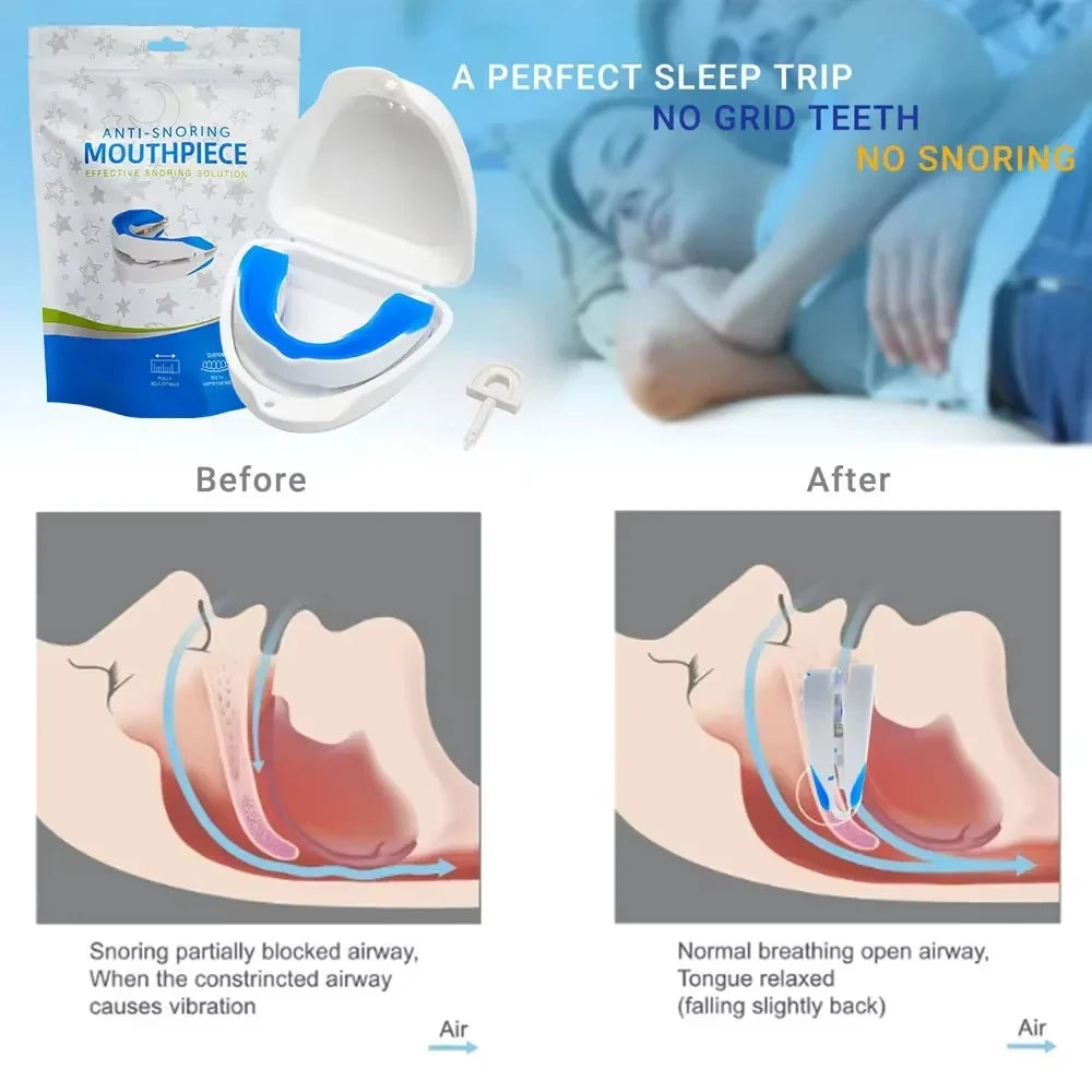 Silicone Anti-Snore Mouthpiece – Mouth Guard for Snoring, Bruxism, Sleep Apnea, and Teeth Protection