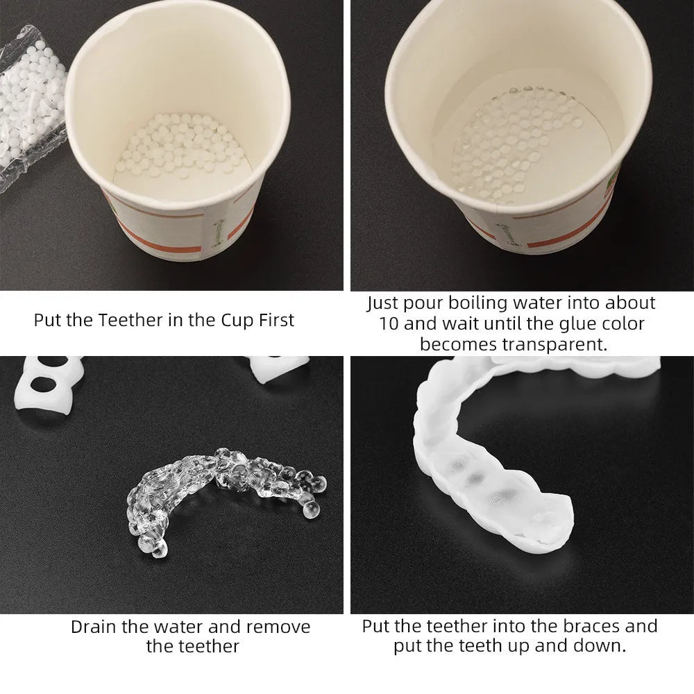 Temporary Tooth Repair Beads – Food Grade Dental Filling Material for Missing or Broken Teeth, False Teeth Glue, Denture Repair