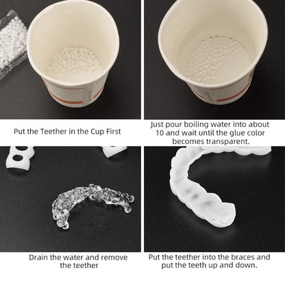 Temporary Tooth Repair Beads – Food Grade Dental Filling Material for Missing or Broken Teeth, False Teeth Glue, Denture Repair