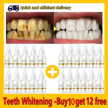 Teeth Whitening Toothpaste – Fruit Acid Formula for Plaque Removal, Stain & Calculus Cleanser, Fresh Breath & Oral Hygiene