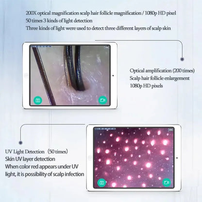 New WiFi HD 5G Scalp & Skin Hair Follicle Detector - Professional 50X/200X Rechargeable UV Skin Analyzer Magnifier