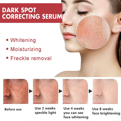 Niacinamide Serum – Dark Spot Correcting, Moisturizing & Brightening, Fades Fine Lines, Deep Cleansing Korean Skincare