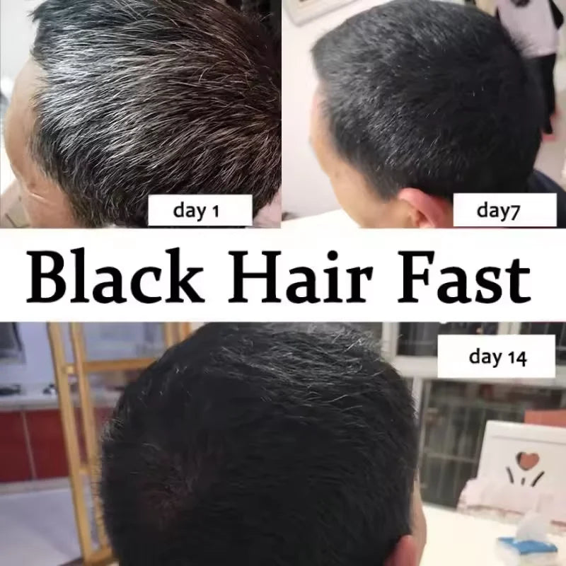 Gray to Black Hair Treatment Serum – Natural Hair Color Repair Spray for Hair Loss & Healthy Hair Care