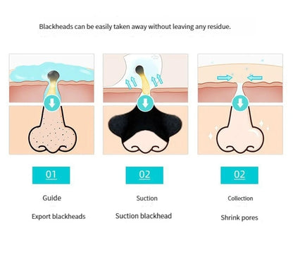 5PCS Blackhead Removal Nasal Strips – Acne & Pore Shrinking, Deep Cleaning Magic Adsorption for Smooth Skin