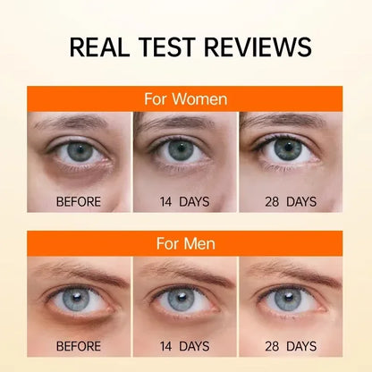 Anti-Dark Circle Eye Serum — Retinol Oil for Wrinkle Removal, Firming, Eye Bag Reduction, Fine Line Fading & Brightening Korean Eye Care