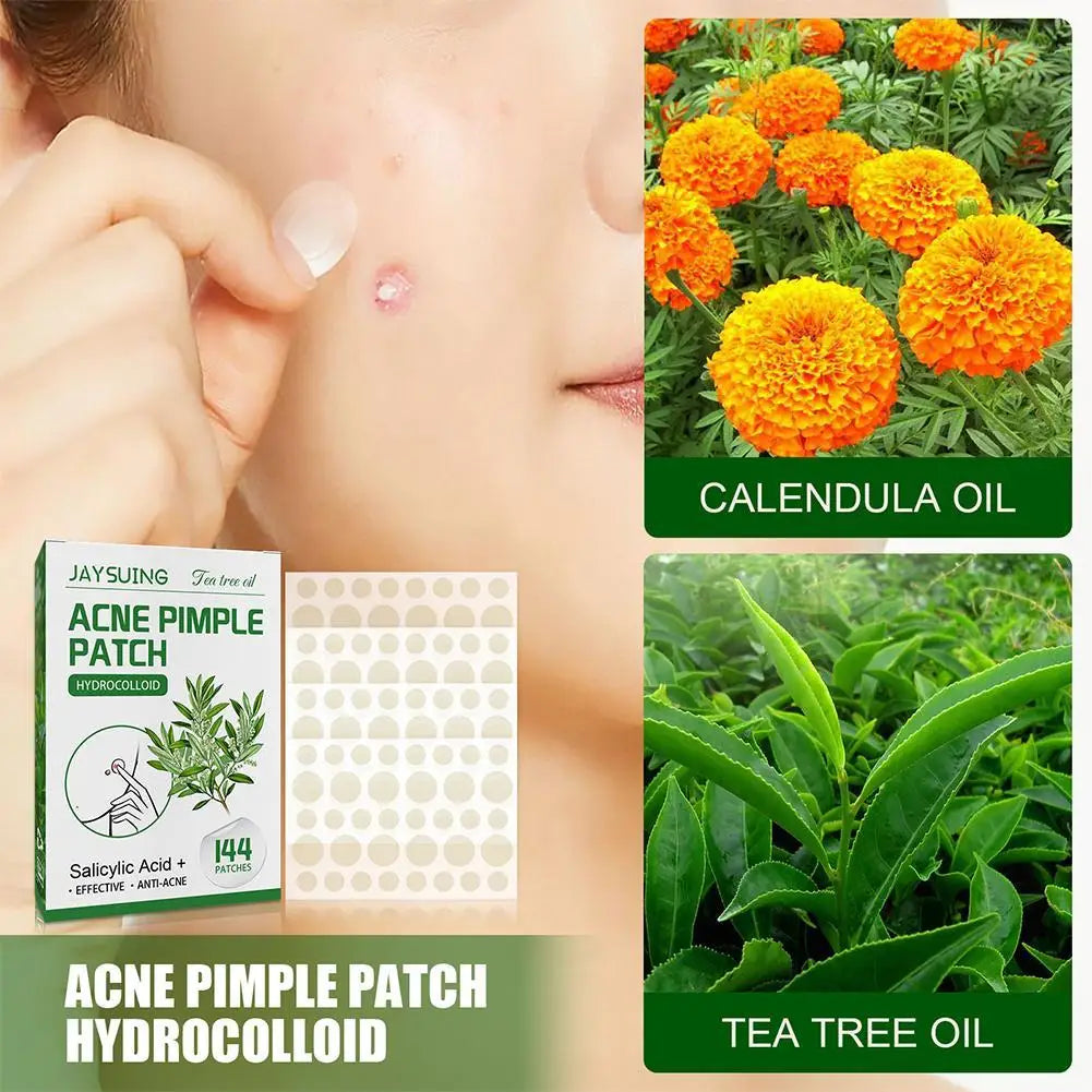 144 Pack Acne Pimple Patches – Translucent Matte Hydrocolloid with Salicylic Acid & Tea Tree Oil for Whiteheads & Inflamed Acne