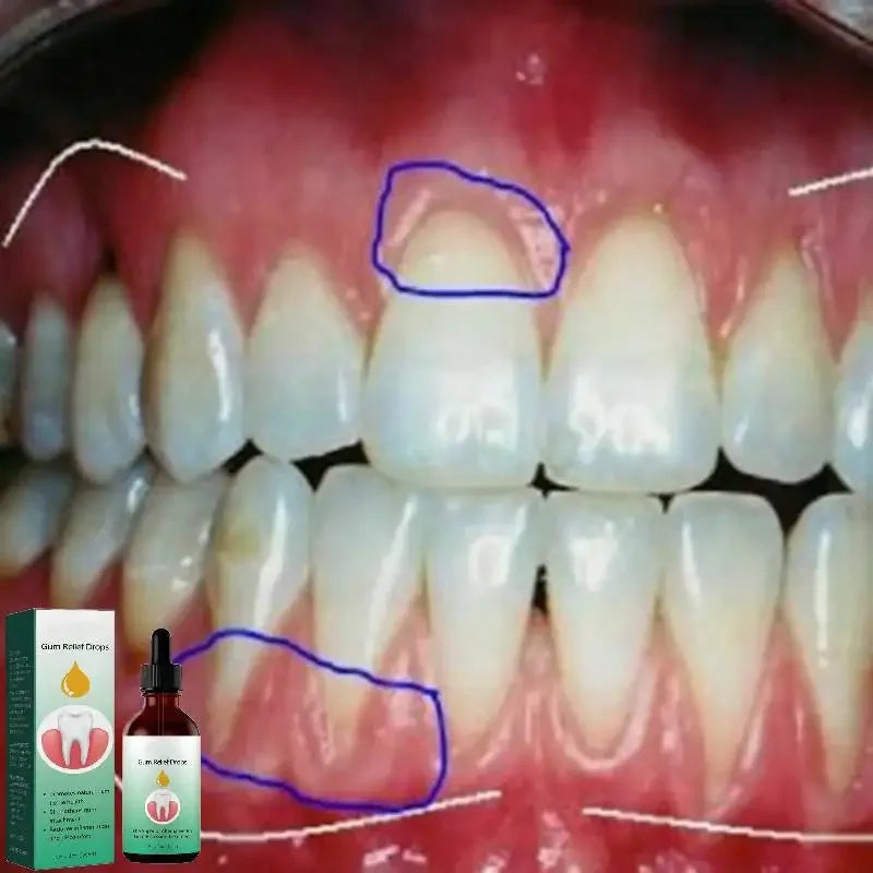Fast-Acting Cavities Repair Mousse Toothpaste - Cleans, Whitens & Removes Yellow Plaque Stains - Relieves Gums, Toothache - Dental Care Solution