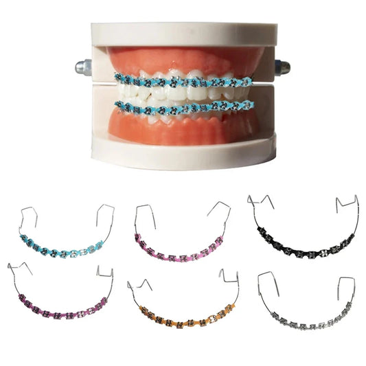 Fashion Braces – Colorful Temporary Tooth Decorations with Metal Wires & Brackets, High-Quality Orthodontic Ligature Ties