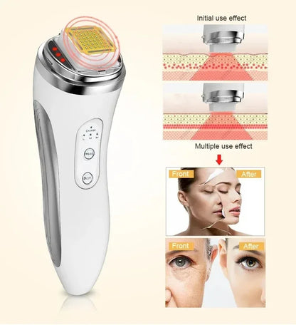 Electric Facial Lifting Machine - Dot Matrix Skin Tightening & Rejuvenation Massager