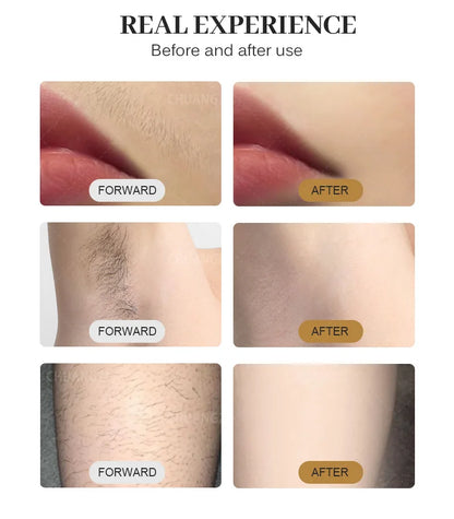 Professional Diode Ice Titanium Laser Hair Removal Machine - 3 Wavelength 755/808/1064nm, Face & Body Epilator for Salon Use