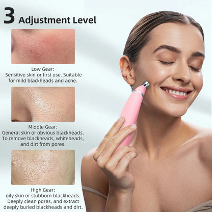 Foreverlily Portable Diamond Peeling Machine – Microdermabrasion Facial Cleaner & Blackhead Remover Vacuum Device