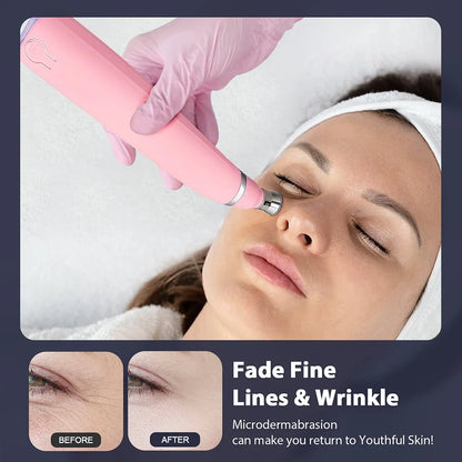 Foreverlily Portable Diamond Peeling Machine – Microdermabrasion Facial Cleaner & Blackhead Remover Vacuum Device