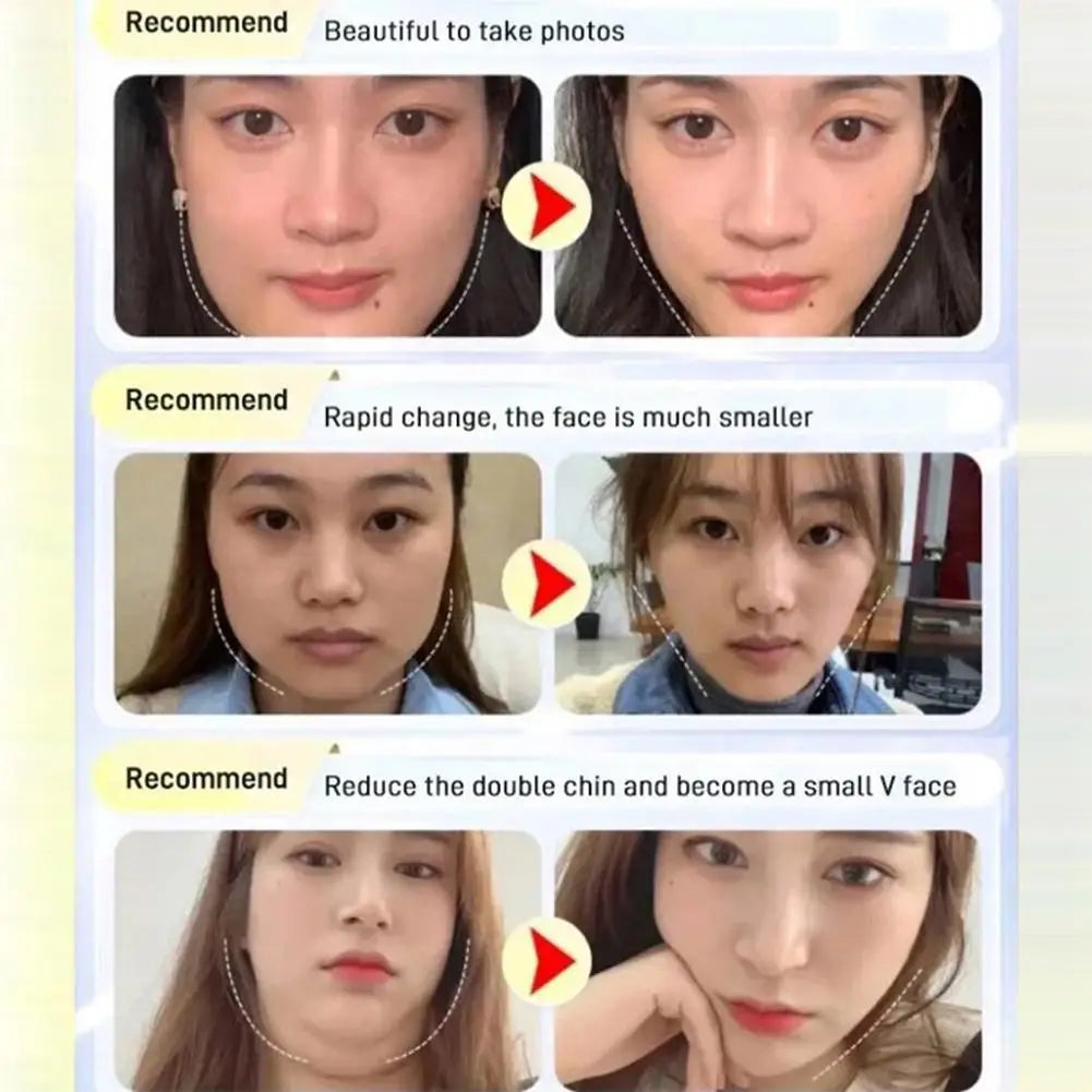 Chin & Cheek Slimming V-Shaper Band — Face Lifting Anti-Wrinkle Strap Mask for Beauty & Health