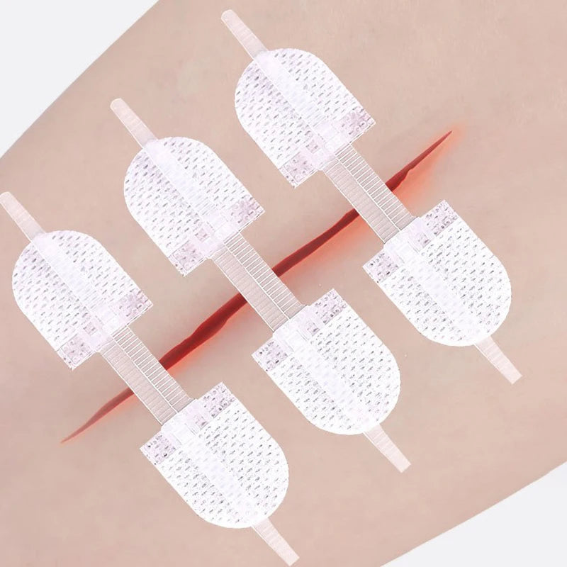 Zipper Wound Closure Device - Suture-Free Laceration Closure Strips for First Aid and Emergency Wound Care