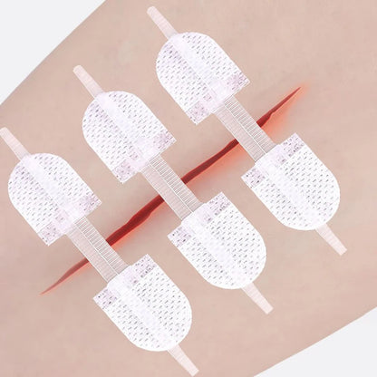 Zipper Wound Closure Device - Suture-Free Laceration Closure Strips for First Aid and Emergency Wound Care