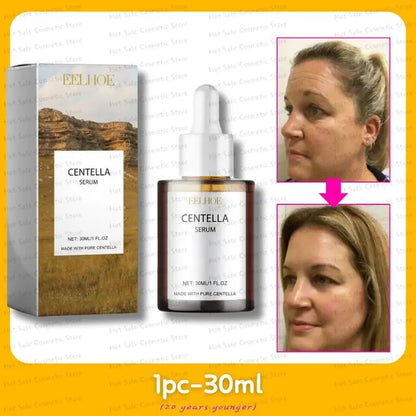 Centella Asiatica Face Serum – Nourishing, Brightening & Moisturizing Cream for Dry Skin Rejuvenation