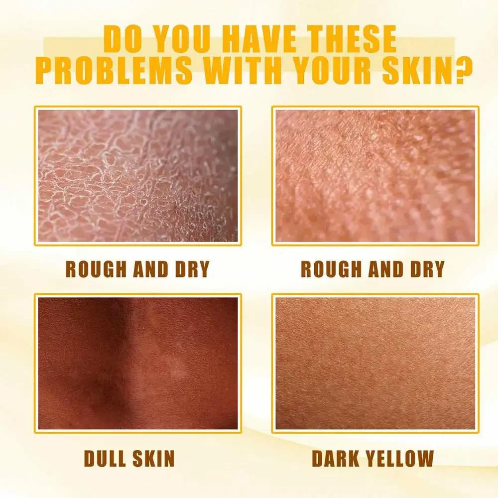 Body Care Exfoliating Yellow Peeling Oil – 100% Organic Dark Skin Whitening Serum for Dark Knuckles and Fast Bleaching