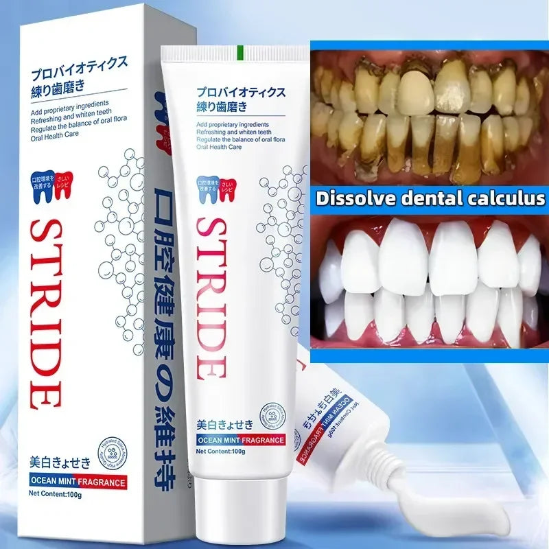Dental Calculus Remover Toothpaste – Whitening, Bad Breath Removal & Periodontitis Prevention for Teeth Car