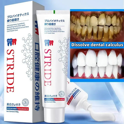 Dental Calculus Remover Toothpaste – Whitening, Bad Breath Removal & Periodontitis Prevention for Teeth Car