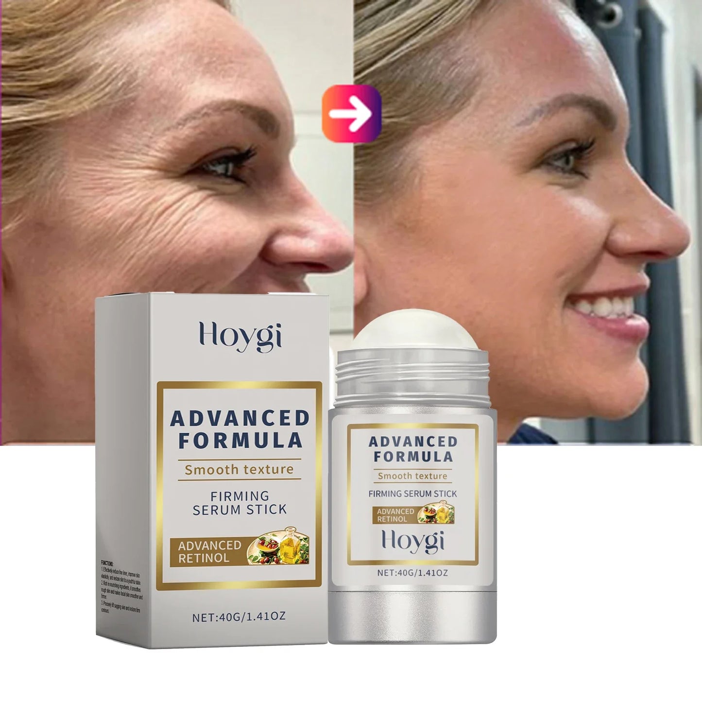 Retinol & Hyaluronic Acid Skin Stick – Anti-Wrinkle Firming & Lifting Balm, 24H Moisturizing Anti-Aging Care for Pores & Skin Plumping