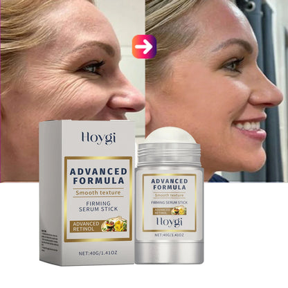 Retinol & Hyaluronic Acid Skin Stick – Anti-Wrinkle Firming & Lifting Balm, 24H Moisturizing Anti-Aging Care for Pores & Skin Plumping